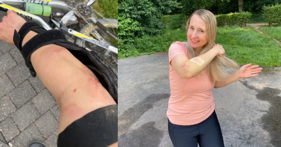 Wundheilung fördern nach Mountainbike Sturz